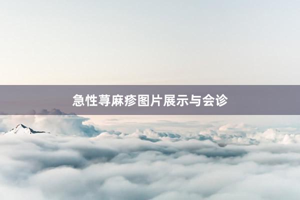 急性荨麻疹图片展示与会诊